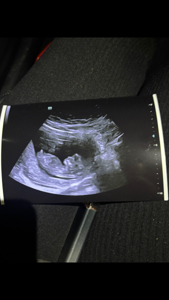 Any suggestions on gender please