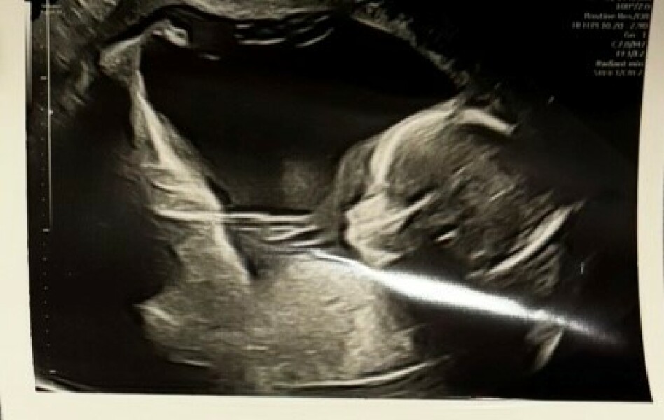This is my 20 week scan - boy or girl?