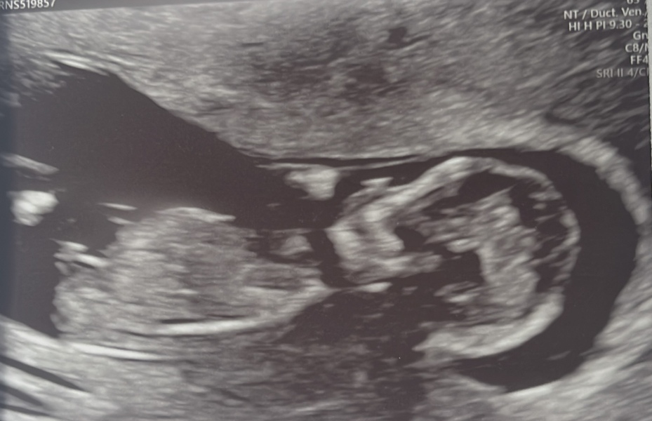 Any guesses what gender my baby might be? ❤️