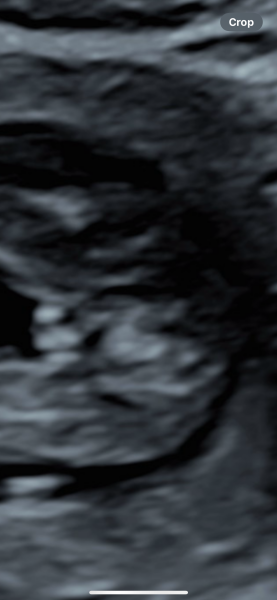 Boy or girl