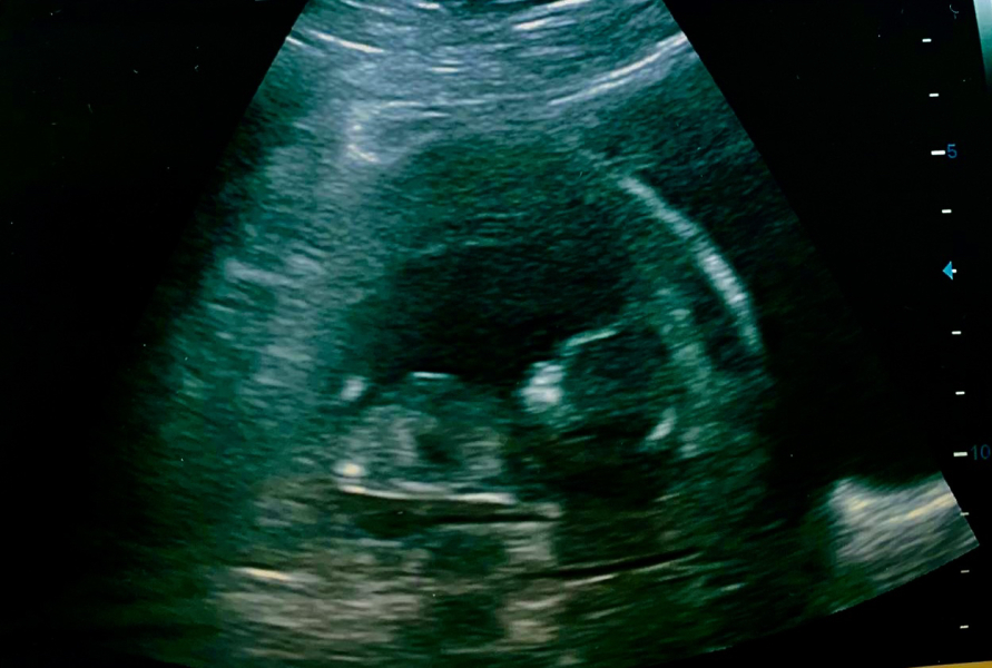 Nub theory pros, is this definitely a boy…?