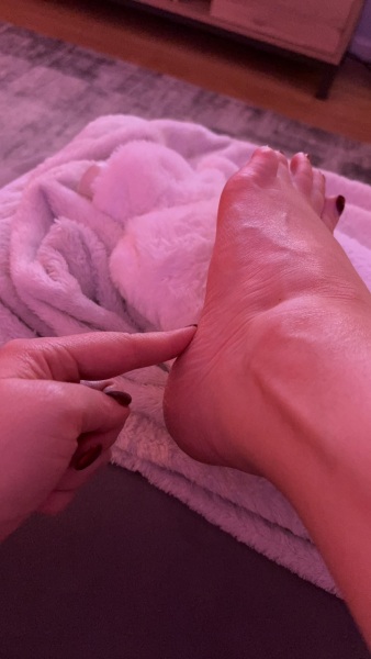 What have I done to my foot?