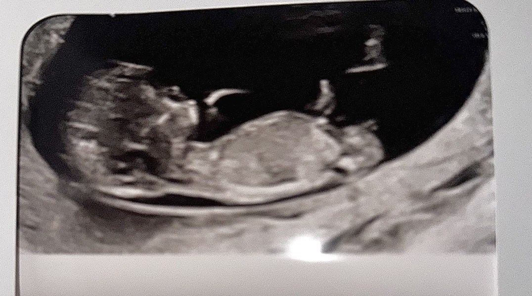 Due July 25 - Thread 2 - Approaching the 12 week scans!