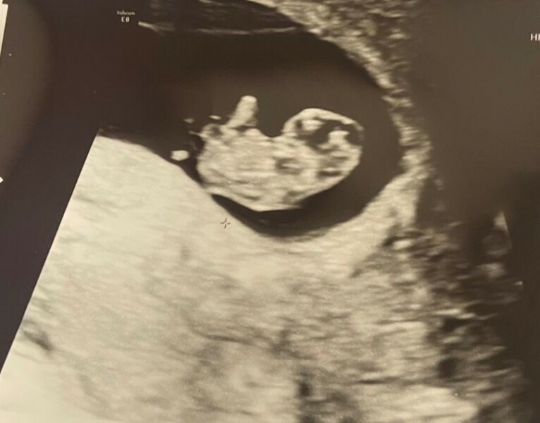 I'm not even 7 weeks yet and I don't know how much longer I have in me