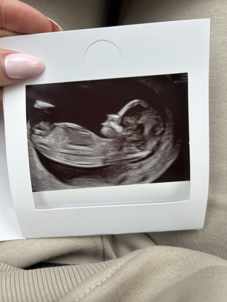 Gender predictions & guesses please!! 🤍