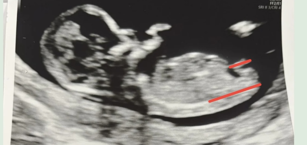 Nub theory gender guesses