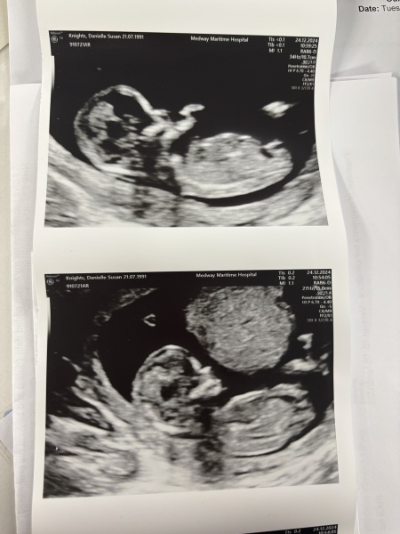 Boy or girl
