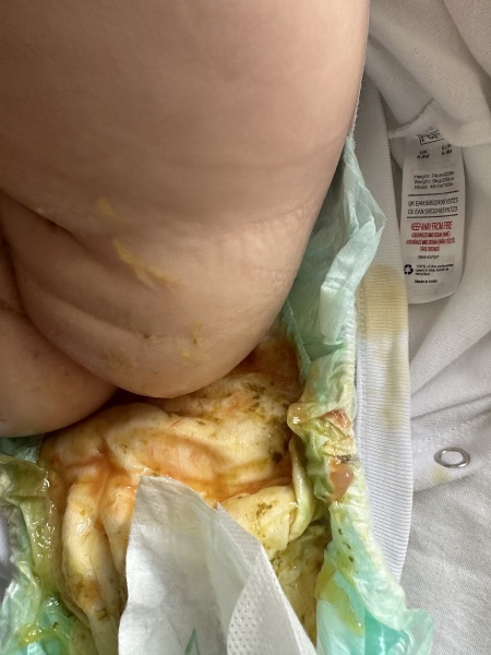 Concerned about the poo