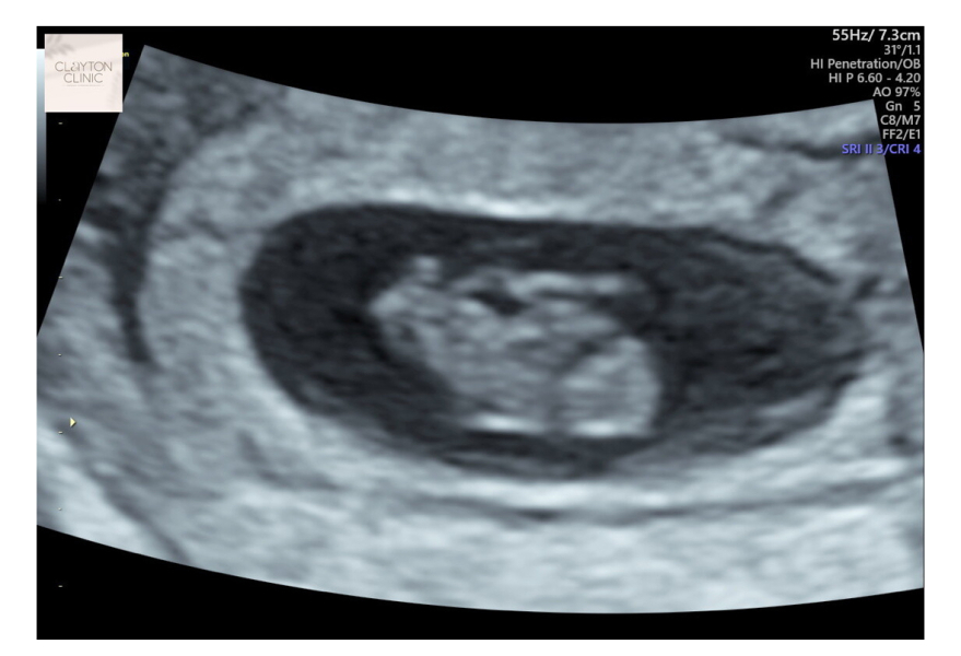 7 and a half weeks