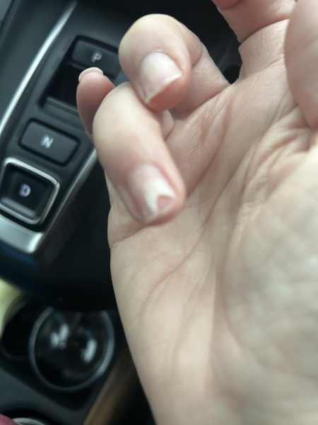 Gel Polish reaction