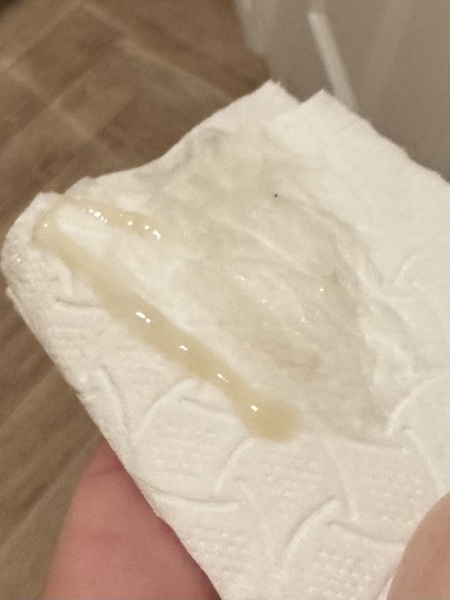 Thick discharge or mucus plug?