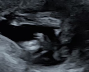 Boy or girl