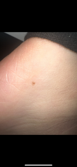 Moles
