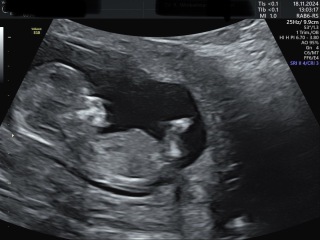 Nub and skull-theorie!What do you think?Was your prediction correct? Experiences?