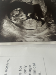 12 week scan gender predictions?