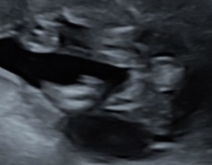 Boy or girl