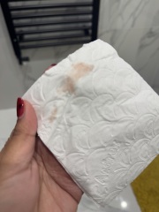 Bleeding in 7 weeks