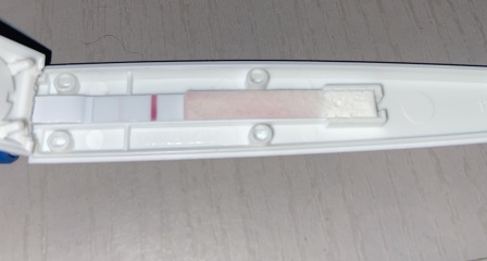 Negative digital test but positive stick test