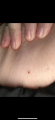 Moles