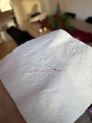 Worms in stool???