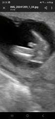 Boy or girl