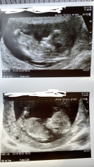 Gender guesses