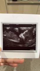 Pregnancy-Gender 12 week scan