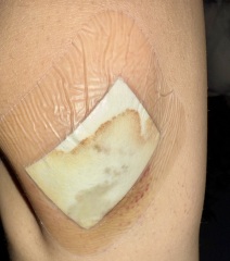 First aid advice please!
