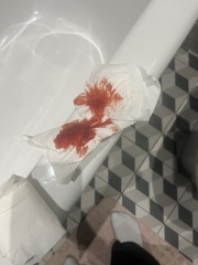 Panicking help, post c-section bleeding pics warning
