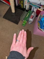 Have I dislocated my finger?! (Photo warning)