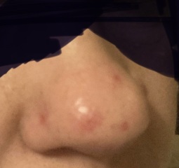 Skin problem