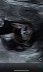 Boy or girl
