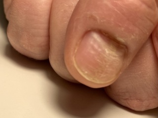What is wrong with my thumbnail?