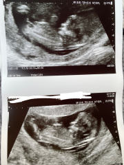 Gender guesses