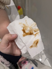 Mucus in child's stool