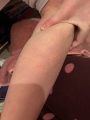 Bed bugs?!
