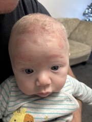 What is this on my sons head???