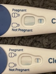 Potentially pregnant -help ! Line eyes
