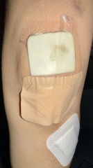 First aid advice please!