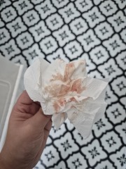 What is this? 🤦🏼‍♀️