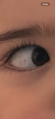 Can anyone put my worried mind at ease? What are these dark spots in my toddler’s eye?