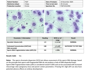 Semen analysis/ sperm agglutination  - chances of natural conception?