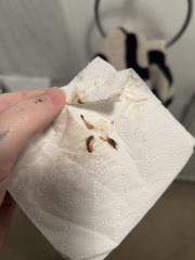 TMI - Mucus Plug? 27+6 wks