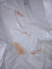 Pink sick, blood or berries? pictures.