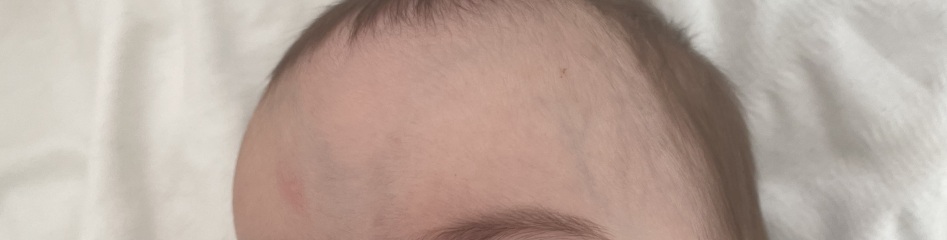 Veins on babies head??
