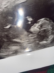 Does my 12 week scan look ok?