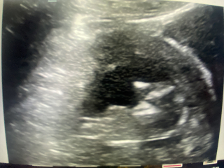 Nub theory pros, is this definitely a boy…?