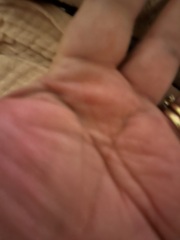 Strange thing with my hands!