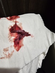 Is this a miscarriage? Sensitive images attached!