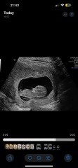 Any Guesses on scan photo?